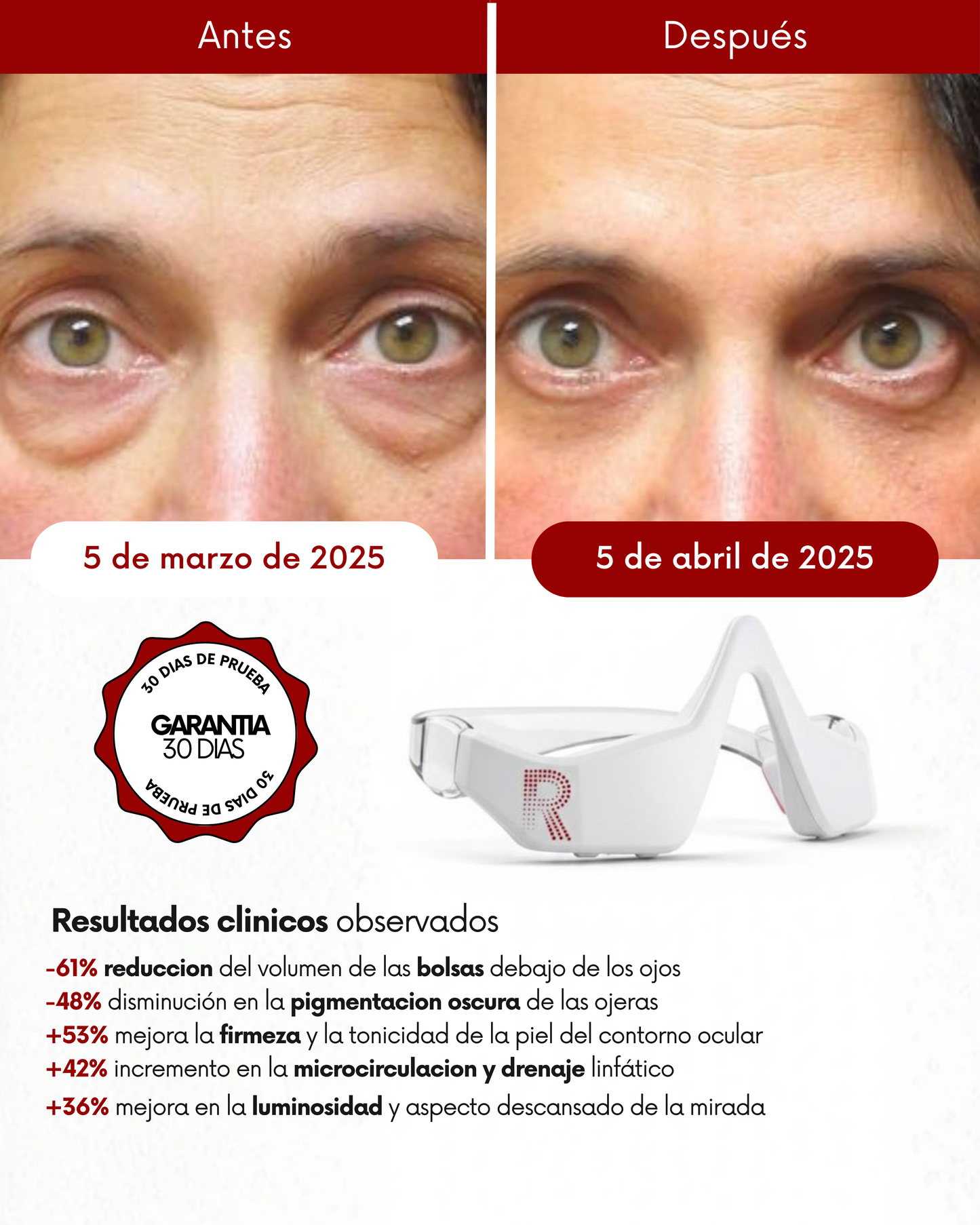 Dermify: Elimina las ojeras y bolsas en 7 días