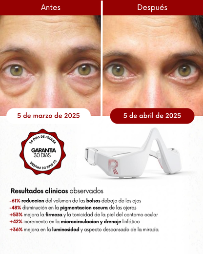 Dermify: Elimina las ojeras y bolsas en 7 días