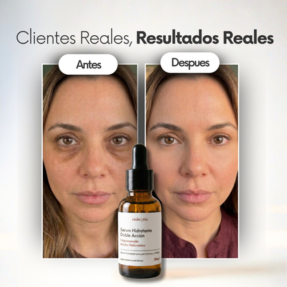 Sérum Antiojeras y Bolsas – Ácido Hialurónico + Niacinamida
