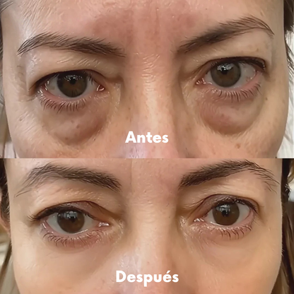 Gafas Redermis: Eliminá las ojeras y bolsas en 7 días