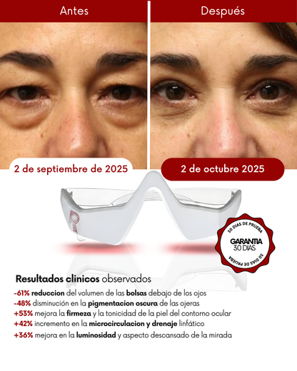 Dermify: Elimina las ojeras y bolsas en 7 días